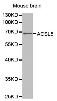 Polyclonal Rabbit anti-Human ACS5 / ACSL5 Antibody (IHC, WB)