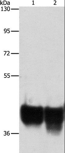 AUP1 Antibody