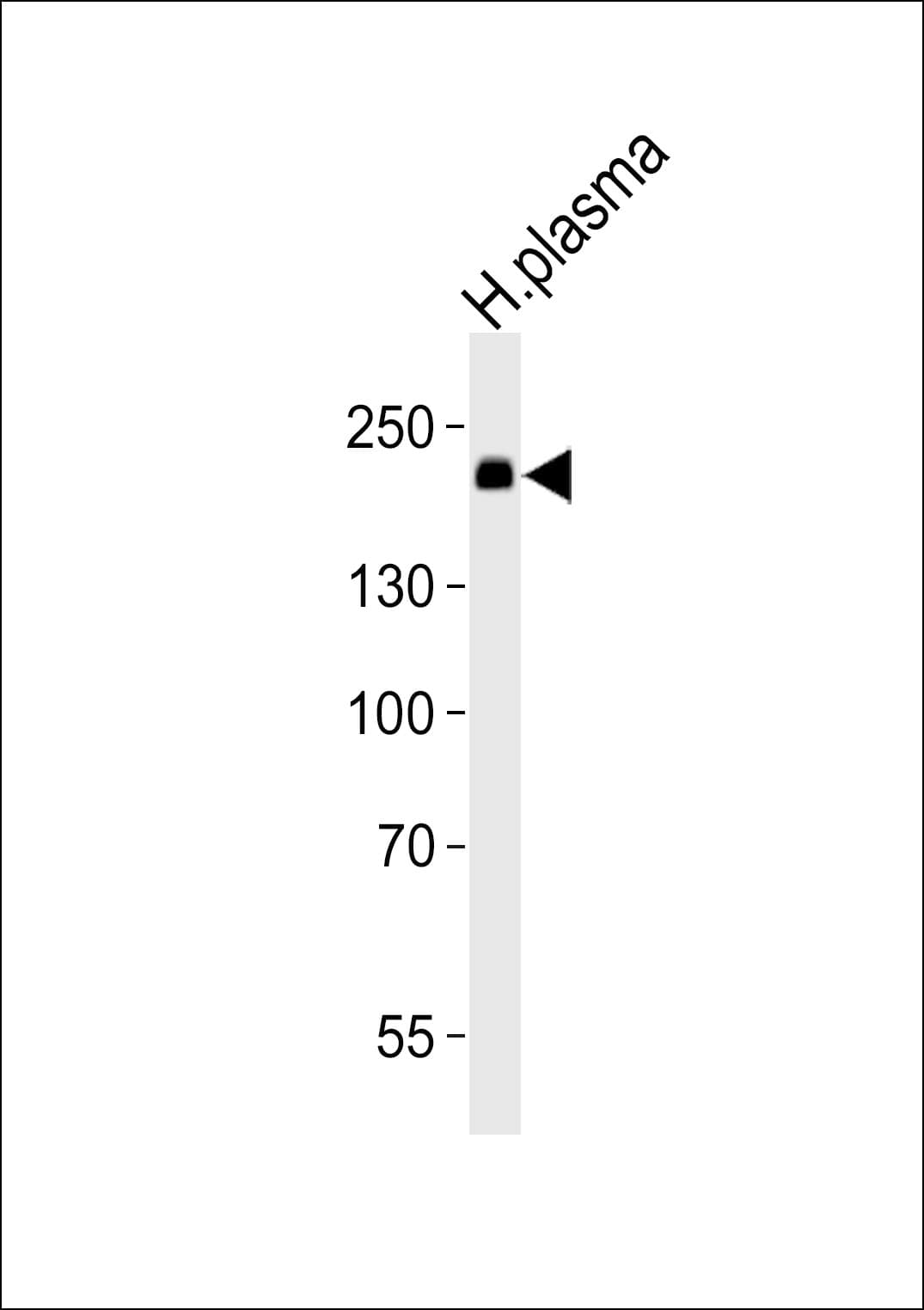 Polyclonal Rabbit anti-Human ATRN / Attractin Antibody (aa32-66, WB)