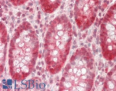 IHC-plus™ Monoclonal Mouse anti-Human TXN / Thioredoxin / TRX Antibody (clone 2A7, IHC, IF, WB)