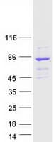 Human RASGRP2 Protein (Recombinant Myc-DDK (Flag))