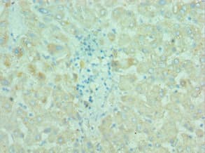BIRC2 / cIAP1 Antibody (aa1-300)