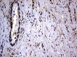 RASGRP3 / GRP3 Antibody (clone OTI2G7)