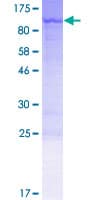 Human PTCD3 Protein (Recombinant GST)