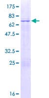Human MAGEB18 Protein (Recombinant GST)