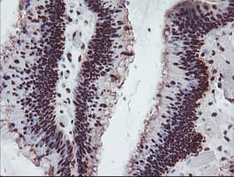 FMR1 / FMRP Antibody (clone OTI1C6)