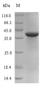 Mycoplasma pneumoniae MPN_083 Protein (Recombinant 6His-SUMO, N-terminus)