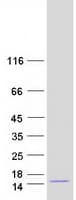 Human MANBAL Protein (Recombinant Myc-DDK (Flag))