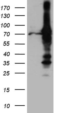 RACGAP1 / MGCRACGAP Antibody (aa123-238, clone OTI3A5, Carrier-free)