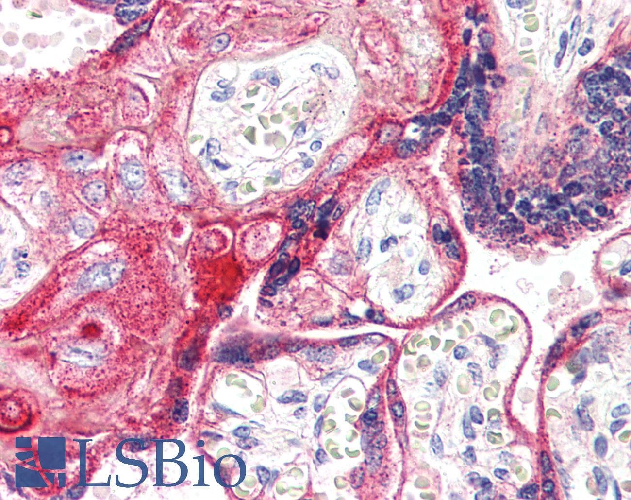 IHC-plus™ Polyclonal Rabbit anti-Human PTGER2 / EP2 Antibody (Internal, IHC)