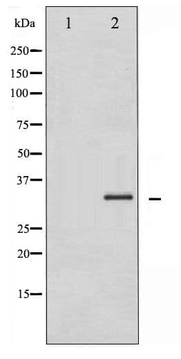 CCND1 / Cyclin D1 Antibody (phospho-Ser90)