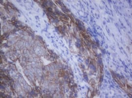 CDH1 / E Cadherin Antibody (clone OTI1F3)