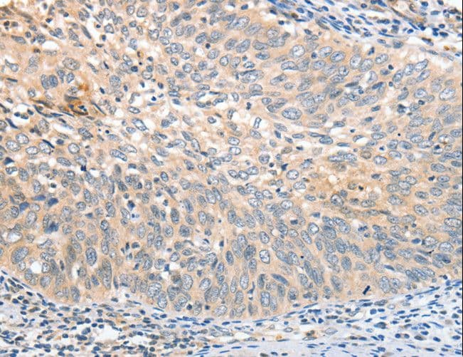 Polyclonal Rabbit anti-Human Aprataxin / APTX Antibody (IHC)