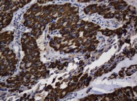ASGR2 Antibody (clone OTI2A12)