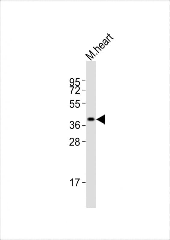 TGFB4 / LEFTY2 Antibody