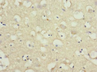 Polyclonal Rabbit anti-Human NRXN3 Antibody (IHC, WB)