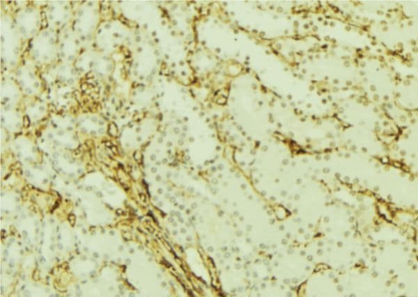 GABARAP Antibody