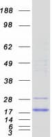 Human CUTA Protein (Recombinant Myc-DDK (Flag))