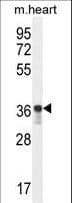 GPD1L Antibody (aa44-73)