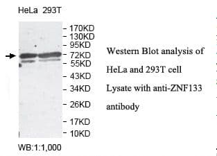 Polyclonal Rabbit anti-Human ZNF133 Antibody (aa388-635, IHC, WB)