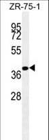 BMP4 Antibody