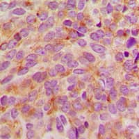 STMN1 / Stathmin / LAG Antibody (N-Terminus)