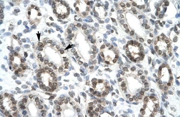Polyclonal Rabbit anti-Human HEY1 Antibody (aa197-246, IHC, WB)