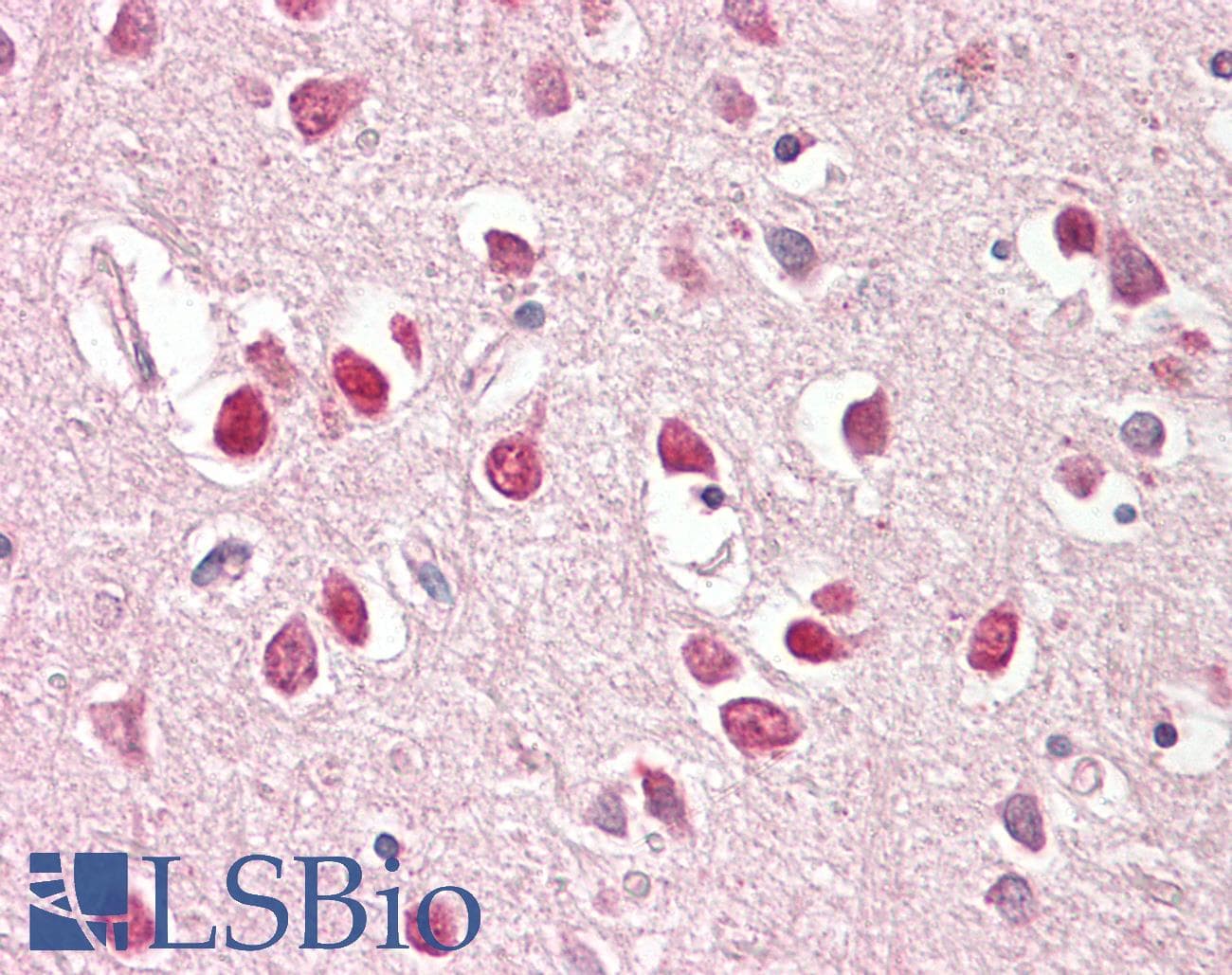 IHC-plus™ BAIAP2 / IRSP53 Antibody (Isoform 3)