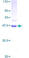 Human STK32A Protein (Recombinant GST)