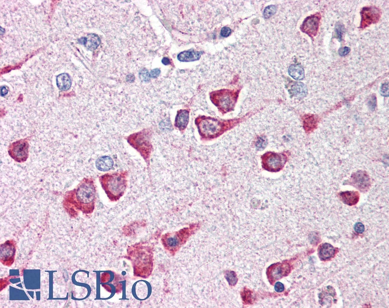 IHC-plus™ FAIM2 / LIFEGUARD Antibody