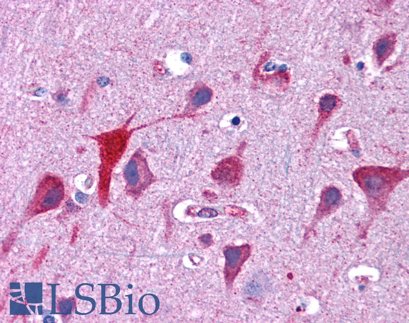 IHC-plus™ Polyclonal Goat anti-Human TPD52L2 / HD54 Antibody (aa195-205, IHC, WB)