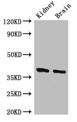 FOXE2 / FOXE1 Antibody