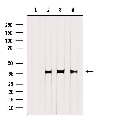 Polyclonal Rabbit anti-Human GALE / UDP-Glucose 4-Epimerase Antibody (WB)