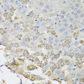 Polyclonal Rabbit anti-Human TROVE2 Antibody (IHC, WB)
