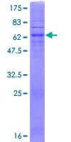 Human SGPP2 Protein (Recombinant GST)