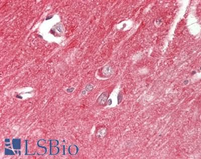 IHC-plus™ PRKCE / PKC-Epsilon Antibody (aa688-737)