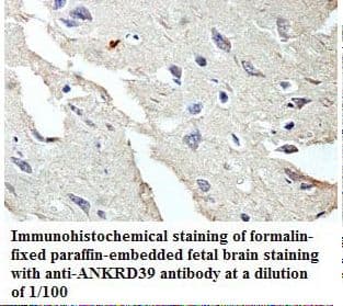ANKRD39 Antibody (aa2-183)