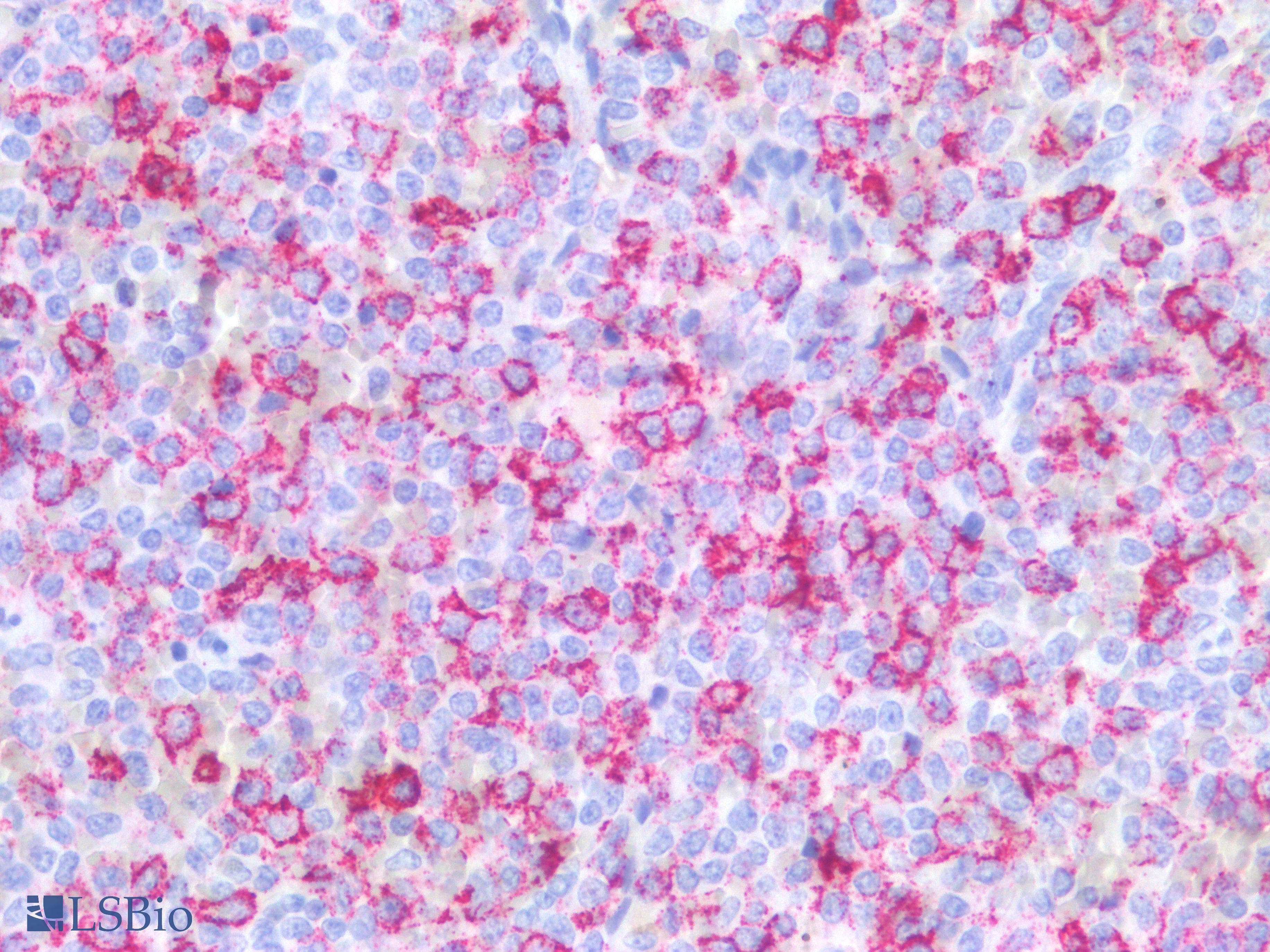 PathPlus™ Monoclonal Mouse anti-Human Hairy Cell Leukemia Antibody (Concentrated, IHC)