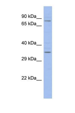 ZFX Antibody (C-Terminus)