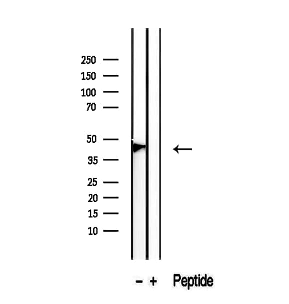 PDPN / Podoplanin Antibody