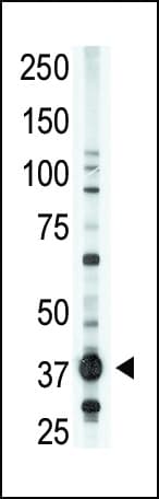 Polyclonal Rabbit anti-Human LPAR1 / LPA1 / EDG2 Antibody (aa21-50, WB)