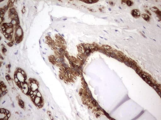Monoclonal Rat anti-Human Acidic Cytokeratin Antibody (clone 2G10, IHC)