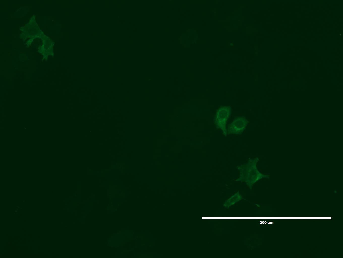 GPR49 / LGR5 Antibody (aa22-543, clone UMAB211)