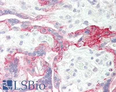PathPlus™ EGFR Antibody (aa1139-1188)