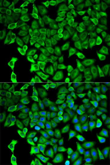 Polyclonal Rabbit anti-Human PSMD2 Antibody (IHC, IF, WB)