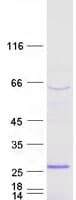 Human SSX3 Protein (Recombinant Myc-DDK (Flag))