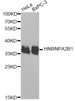 HNRNPA2B1 Antibody