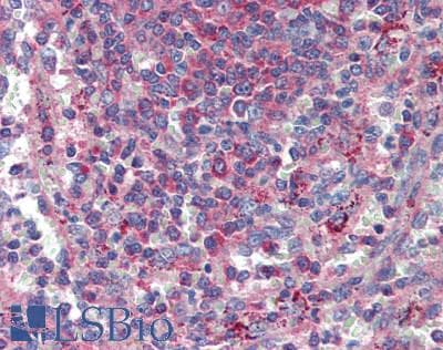IHC-plus™ EIF3S5 / EIF3F Antibody