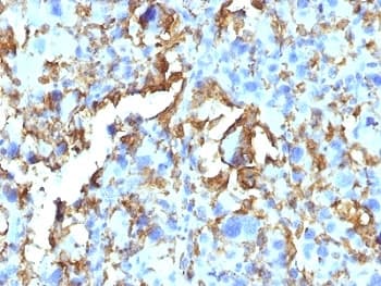 HLA-DRB1 Antibody (clone HLA-DRB/1067)