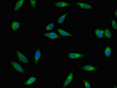 Polyclonal Rabbit anti-Human RGS4 Antibody
